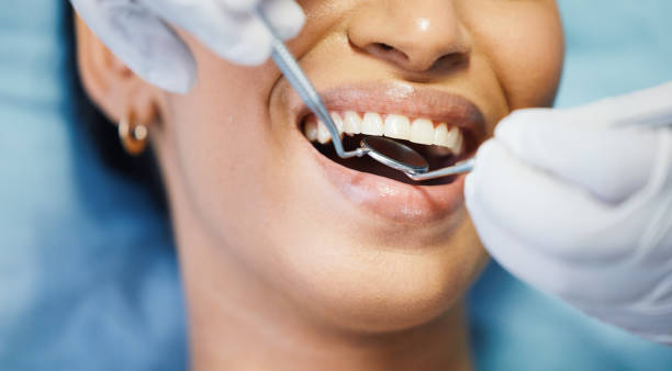Best Knocked-Out Tooth (Avulsed Tooth) Treatment in Hapeville, GA
